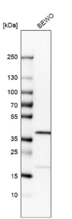 RP2 Antibody, Novus Biologicals:Antibodies:Primary Antibodies